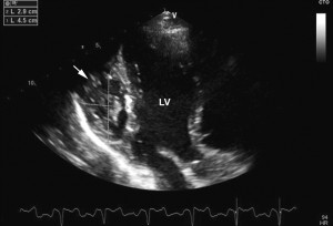 fig 2-8-2-23