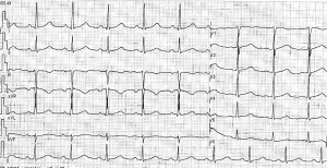 fig 1-8-4-21