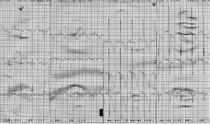 fig 4-7-4-21