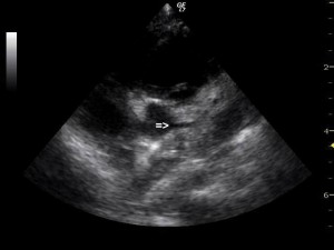 fig 7-7-4-21